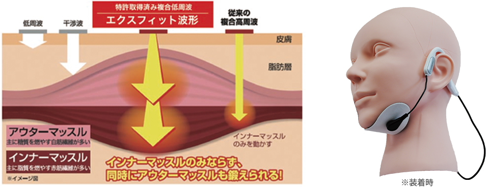 ごっくん楽の複合低周波開発とその経緯